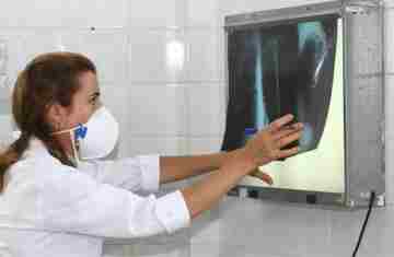  OMS recomenda testes de diagnóstico rápido para erradicar tuberculose 